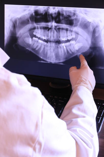 Best Emergency Root Canal Therapy in Barnwell, SC