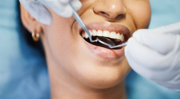Best Dental Abscess Treatment in Barnwell, SC