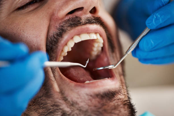 Best Emergency Dental Care for Sports Injuries in Barnwell, SC